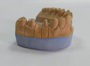 Продам Супер гипс для зубных техников и для стоматологов.