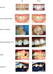 стоматология,  лечение зубов и десен